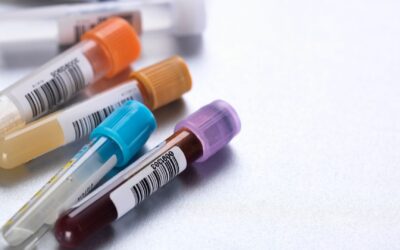 Pruebas médicas y detecciones esenciales para la salud cardíaca